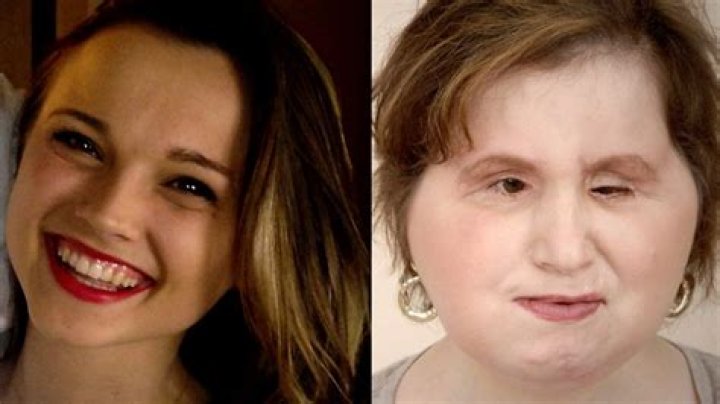Katie Stubblefield Before and After Accident: Why Did She Shot Herself? Reddit